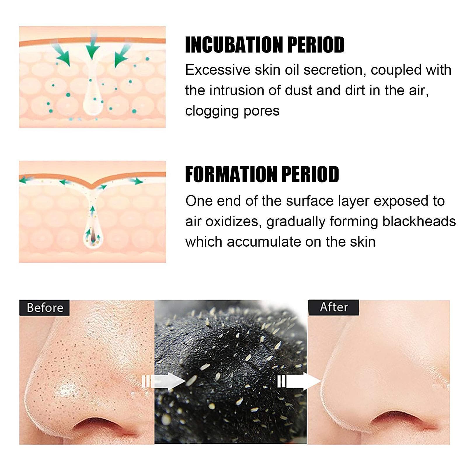 10 Pcs Blackhead Nose Patch Nose Pore Cleansing Strips Deep Cleansing Blackhead Remover Strips For Women Men 3